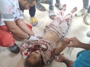 شهيدة طفلة جراء قصف الاحتلال خيمة نازحين غربي خان يونس