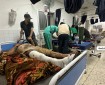 مدير "الشفاء": نفاضل بين الجرحى والمرضى لانعدام الإمكانيات