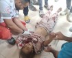 المصابون في غزة محكوم عليهم بالاستشهاد لهذا السبب