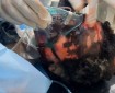 56 شهيدا في قصف الاحتلال مناطق متفرقة من قطاع غزة