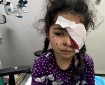 غزة: 1500 فقدوا البصر وآلاف مهددون بسبب انهيار خدمات العيون