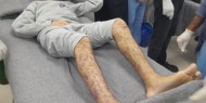 إعلام الأسرى: المحررون بالصفقة تعرضوا للضرب لأيام
